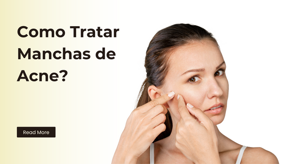 Saiba como tratar manchas de acne de forma eficaz! Descubra dicas de produtos, tratamentos caseiros e dermatológicos para clarear manchas e prevenir hiperpigmentação.